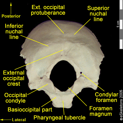 Osteology Of The Skull: Cranial Bones Of The Brain Case – Forensics