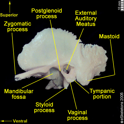 Osteology of the Skull: Cranial Bones of the Brain Case – FORENSICS