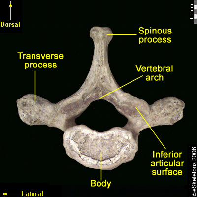 Osteology of the Vertebral Column – FORENSICS