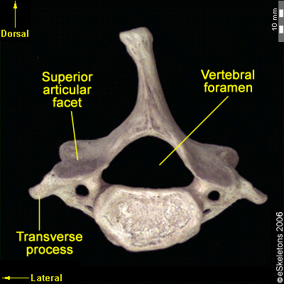 Osteology of the Vertebral Column: Cervical Vertebrae – FORENSICS