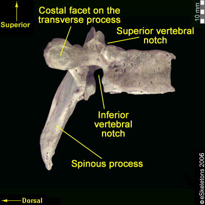 Osteology of the Vertebral Column: Thoracic Vertebrae – FORENSICS